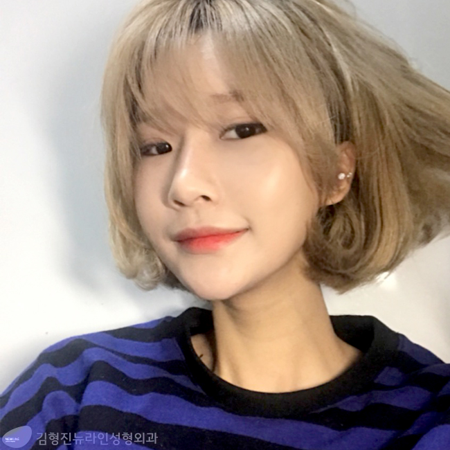 지방이식잘하는곳 여기에요!~ 관련 이미지 2