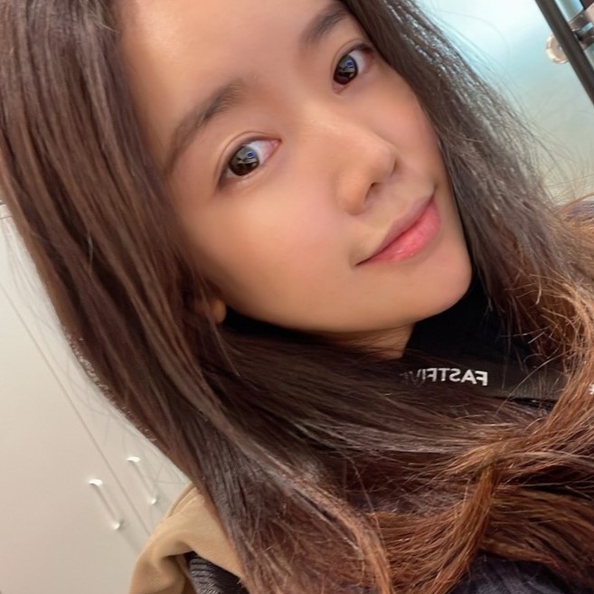 눈밑수술잘하는곳에서 재발없이 오래 유지하는 방법 관련 이미지 3