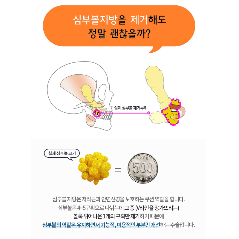 얼굴지방흡입전후 얼굴선이 또렷해지는 이유 관련 이미지 5