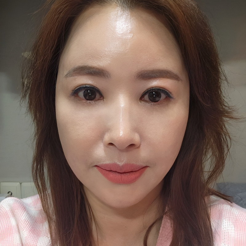 중년하안검 아무거나 하지 마세요 관련 이미지 1