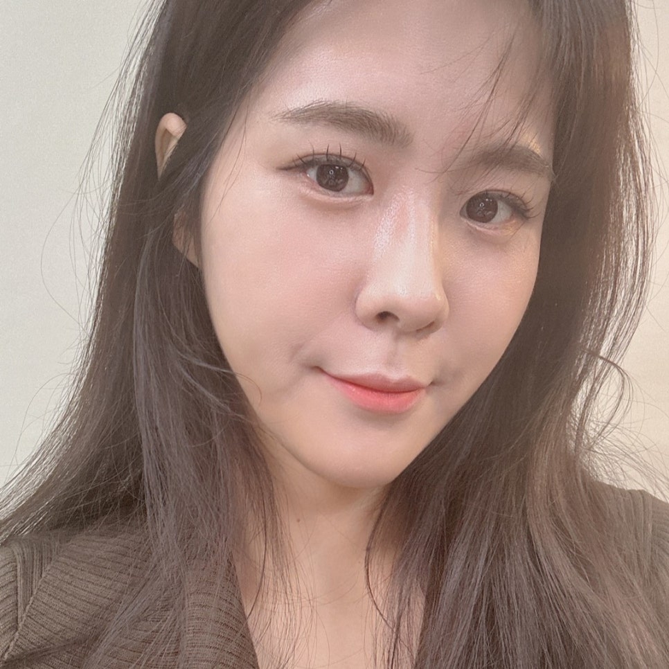 눈밑지방재배치후기 미묘한 차이가 인상을 바꿔요 관련 이미지 4
