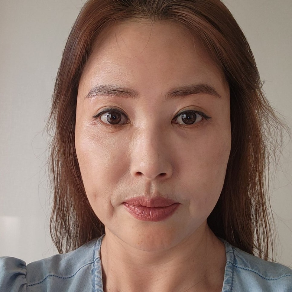 일단 효도성형후기 보고 결정하세요! 관련 이미지 1