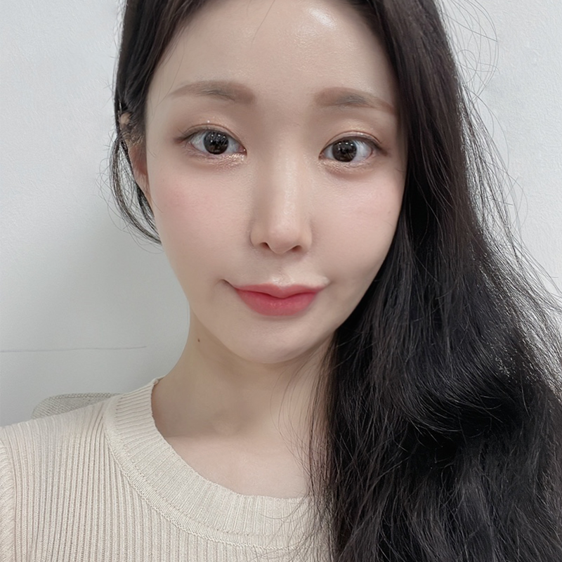 침샘비대증치료 어렵지 않아요! 관련 이미지 6