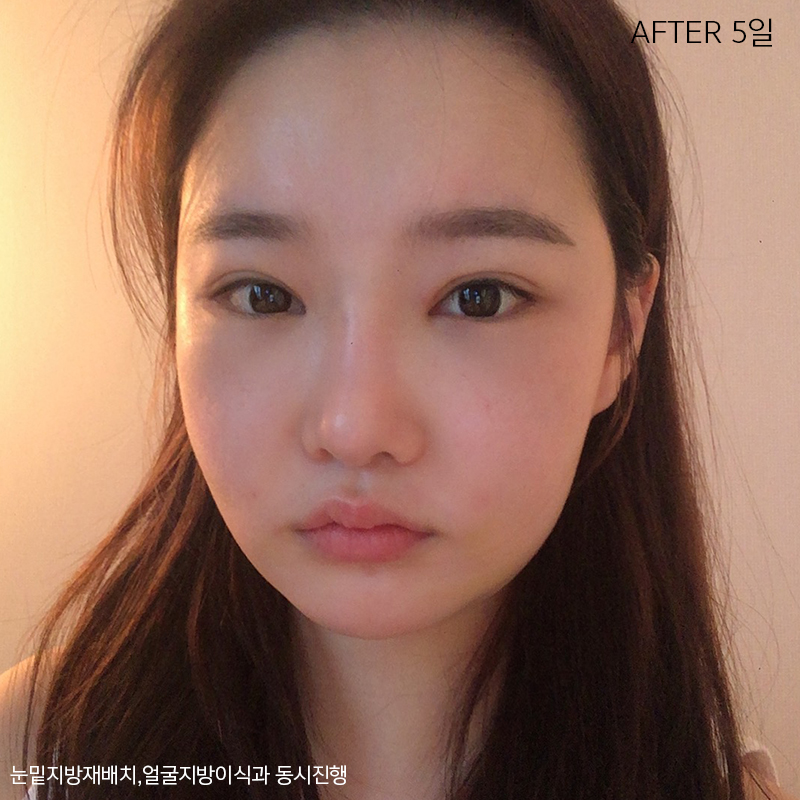 얼굴지흡방법 아직 모르신다구요? 관련 이미지 3