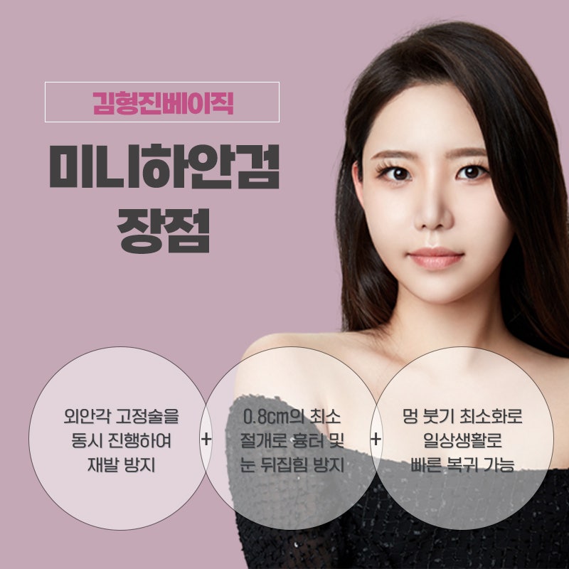 압구정하안검 김형진베이직에서 미니하안검으로 가볍게 해결해요! 관련 이미지 3