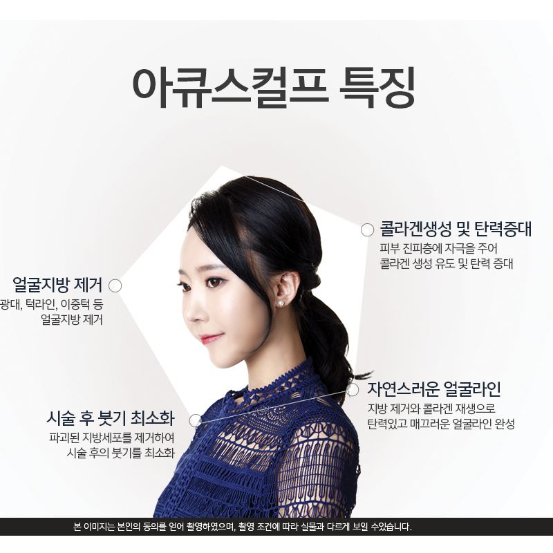 아큐스컬프로 얼굴살 깔끔하게 해결 관련 이미지 6