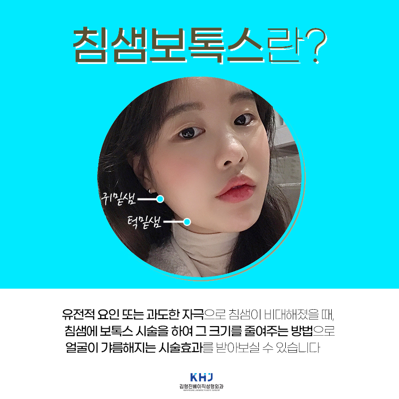수많은 침샘보톡스후기가 증명해주는 김형진베이직 관련 이미지 4