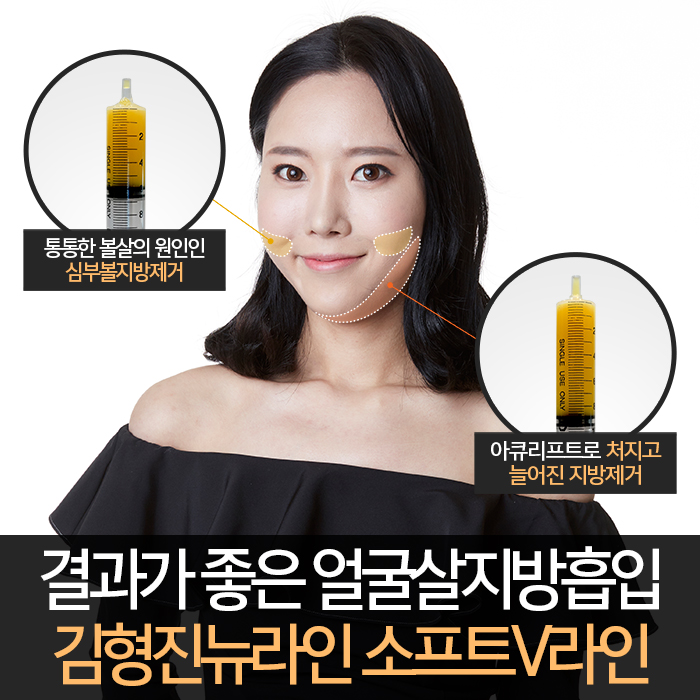 얼굴전체지방흡입 리얼후기 공개 관련 이미지 3