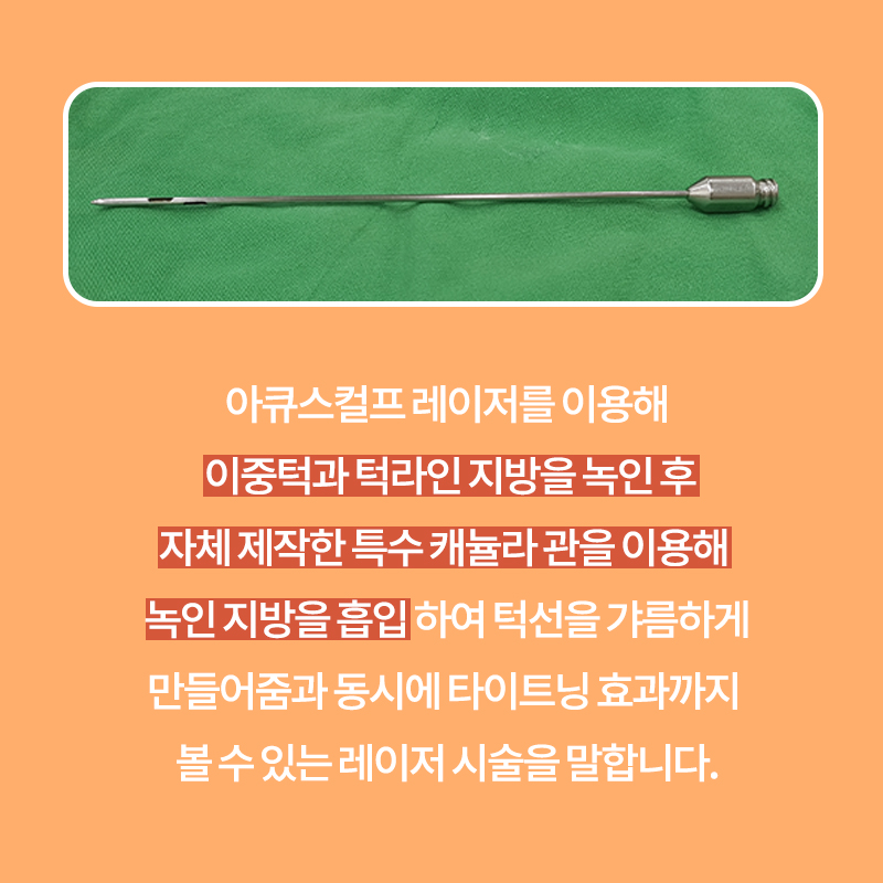 이중턱해결방법 여기예요 여기! 관련 이미지 3