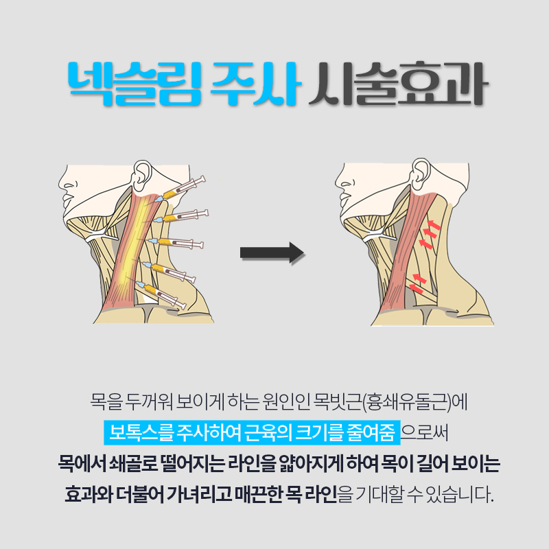 넥슬림주사시술 알아보는 중이라면 관련 이미지 3