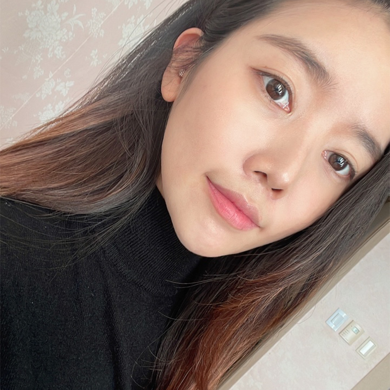 눈밑지방재배치유지력 오래가는 곳 찾으신다면? 관련 이미지 2