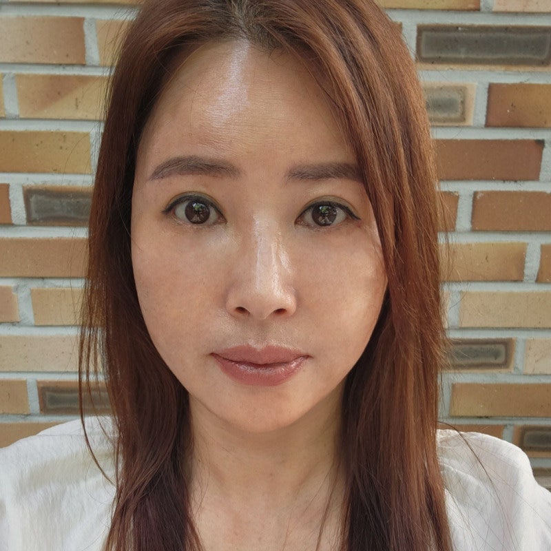중년미니하안검으로 눈 밑 고민 해결했어요! 관련 이미지 2