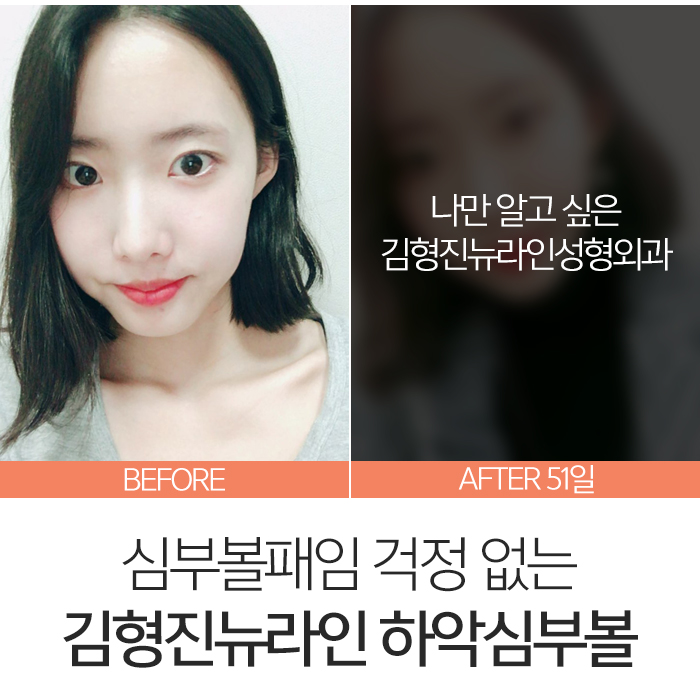 심부볼패임 어떻게 하느냐에 따라 달라요 관련 이미지 7