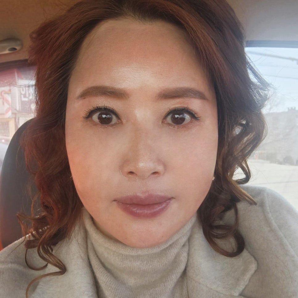 눈밑처짐수술 계속 고민 중이라면 관련 이미지 1