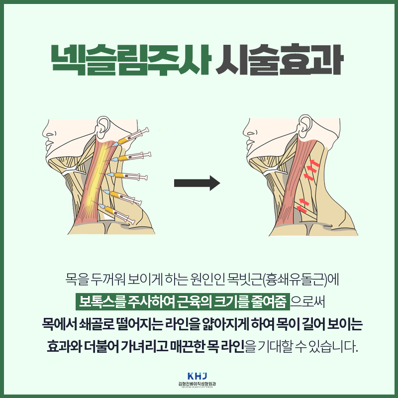 목얇아지는법 모르겠다면 들어오세요! 관련 이미지 5