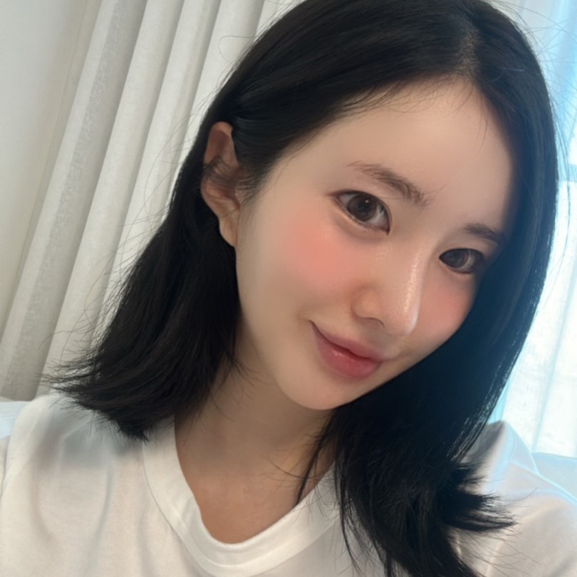 심부볼지방제거로 얼굴형 고민 해결했어요! 관련 이미지 2