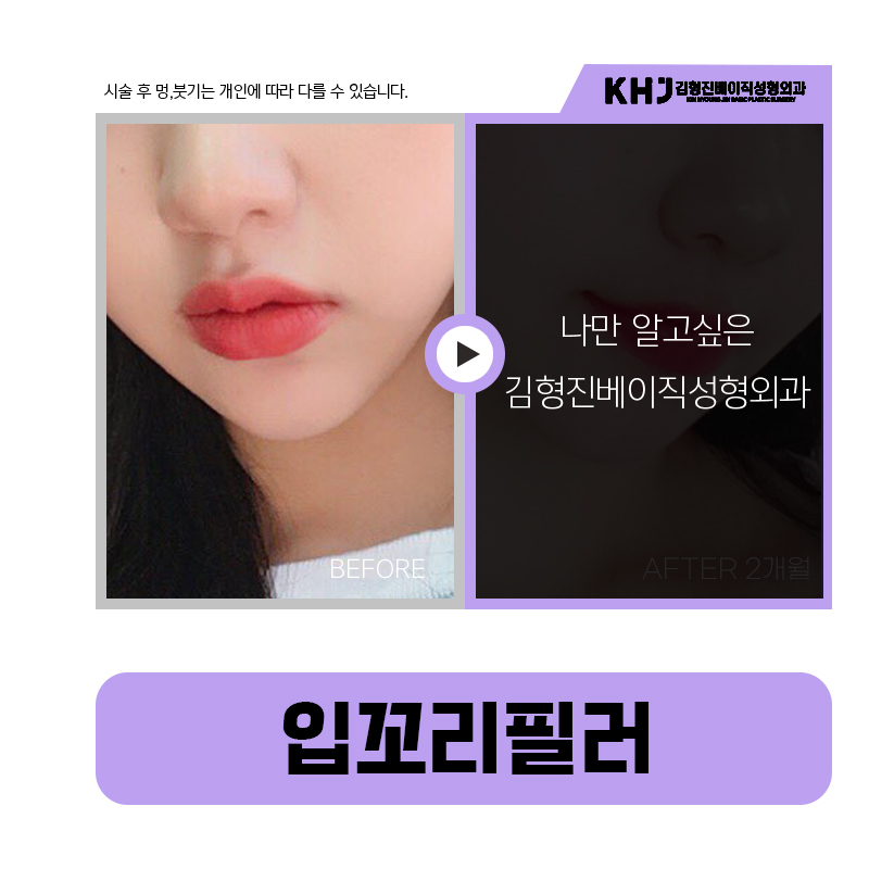 쉽고 간단하게 처진입꼬리 올리는법 관련 이미지 5