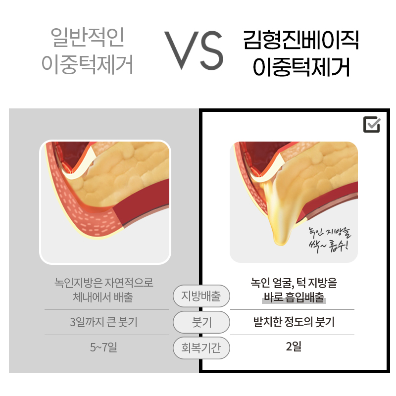 강남얼굴지방흡입은 무조건 김형진베이직이라고 하는 이유 관련 이미지 6