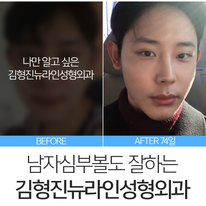 남자심부볼 깔끔하게 정리해요 관련 이미지 2