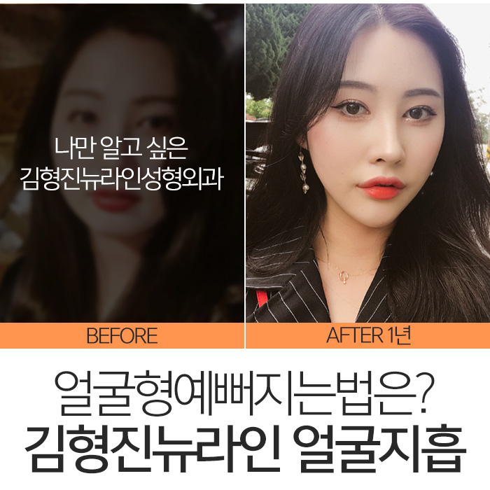 얼굴형예뻐지는법 확실한건 관련 이미지 8