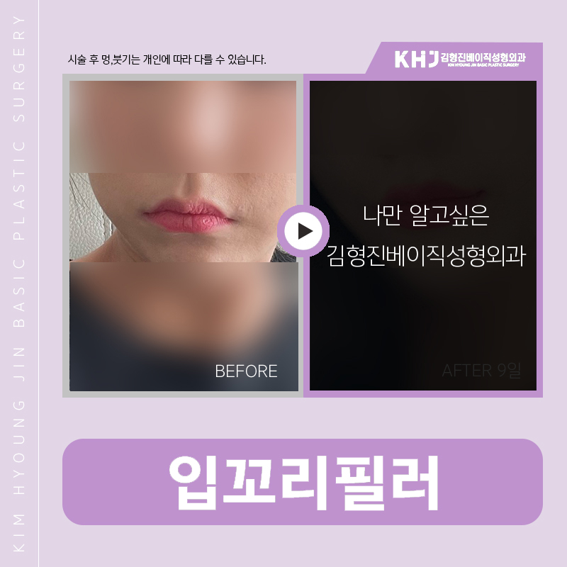 입꼬리올리는방법 진짜 알려드릴까요? 관련 이미지 5