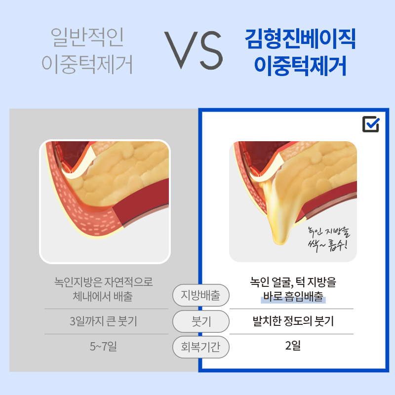 이중턱빼는법 다이어트로는 해결이 어려울까요? 관련 이미지 5