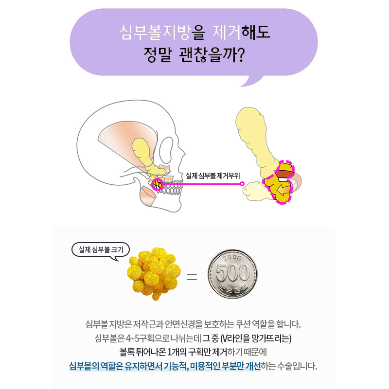얼지흡이 이렇게 자연스러울 수 있을까요? 관련 이미지 4