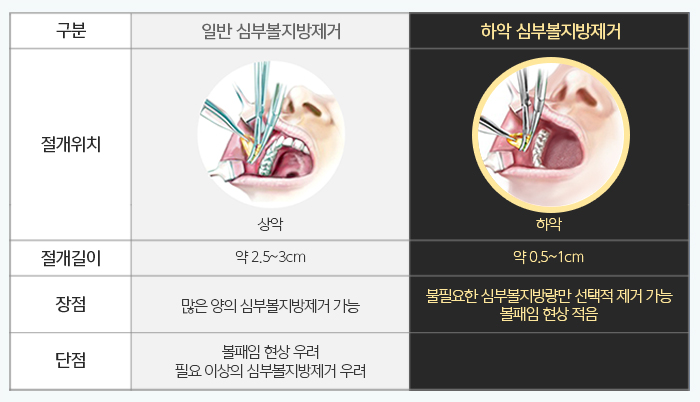 심술보리프팅 김형진뉴라인에서는? 관련 이미지 5