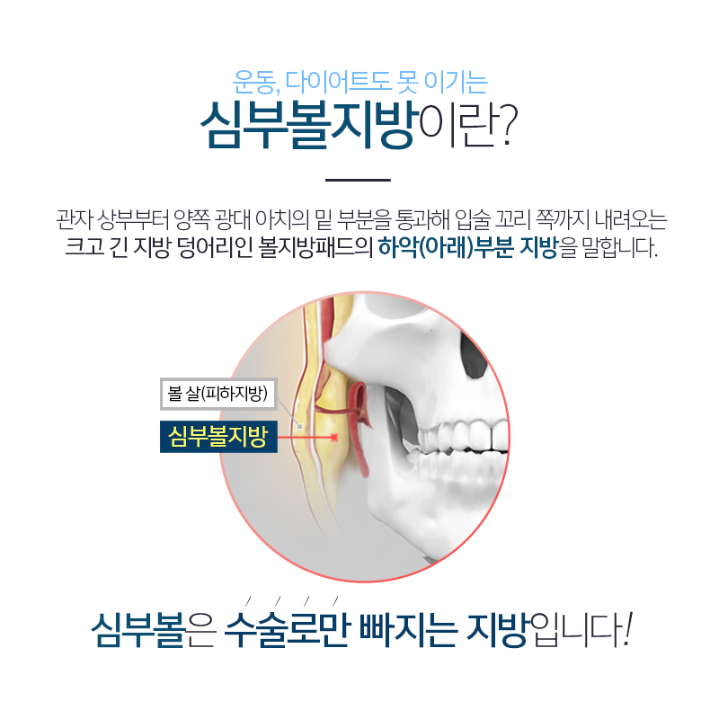 하악심부볼제거로 갸름한 얼굴라인을! 관련 이미지 2