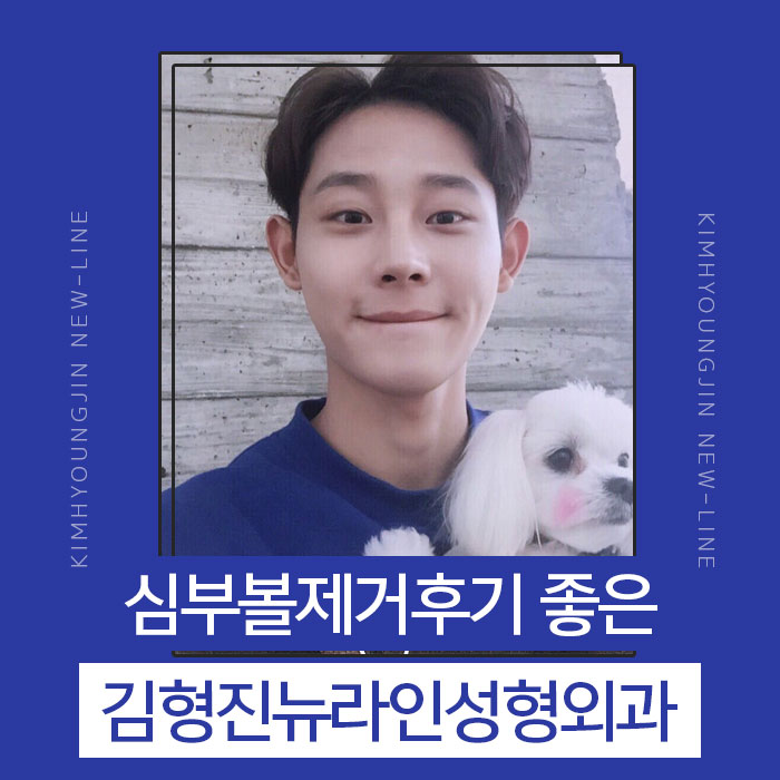심부볼제거후기 좋을 수 밖에 없는 관련 이미지 1