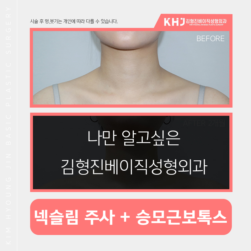 예비신부관리 시작해보자구요! 관련 이미지 2