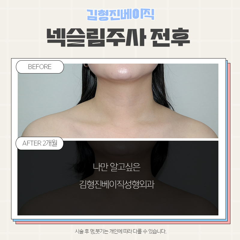 목얇아지는법 어렵지 않아요! 관련 이미지 4