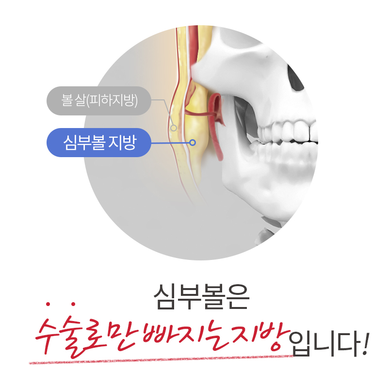 심부볼윤곽주사 과연 효과 있을까요? 관련 이미지 3