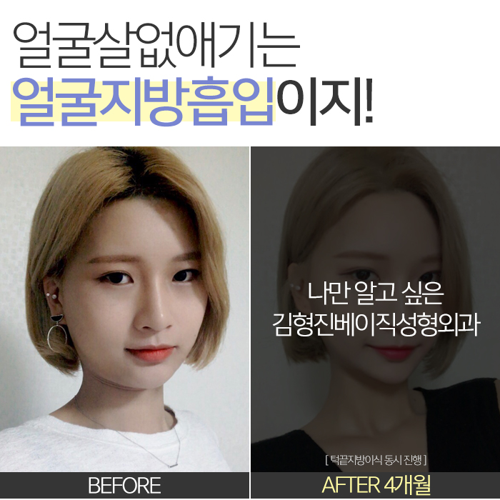 얼굴살없애기 이걸 몰랐단 말이야? 관련 이미지 6