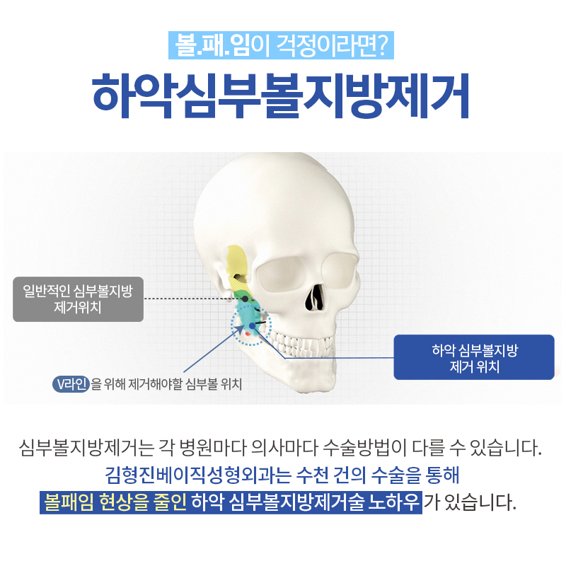 심부볼패임 너무 걱정된다구요? 관련 이미지 5