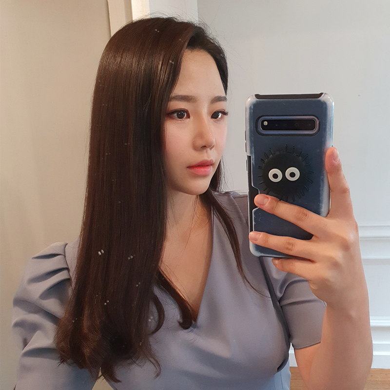 침샘보톡스효과 좋은 김형진베이직 관련 이미지 3