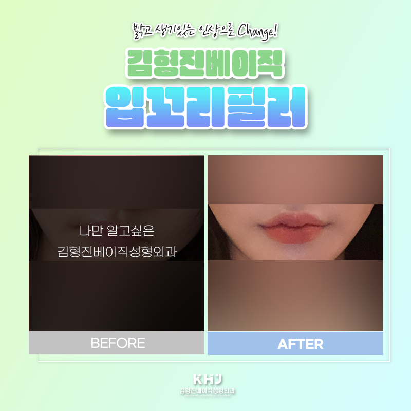 입꼬리올리는법 궁금하셨죠? 관련 이미지 4