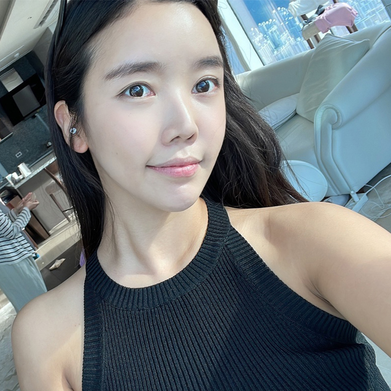 이중턱지방흡입전후 차이가 큰 김형진베이직 관련 이미지 1