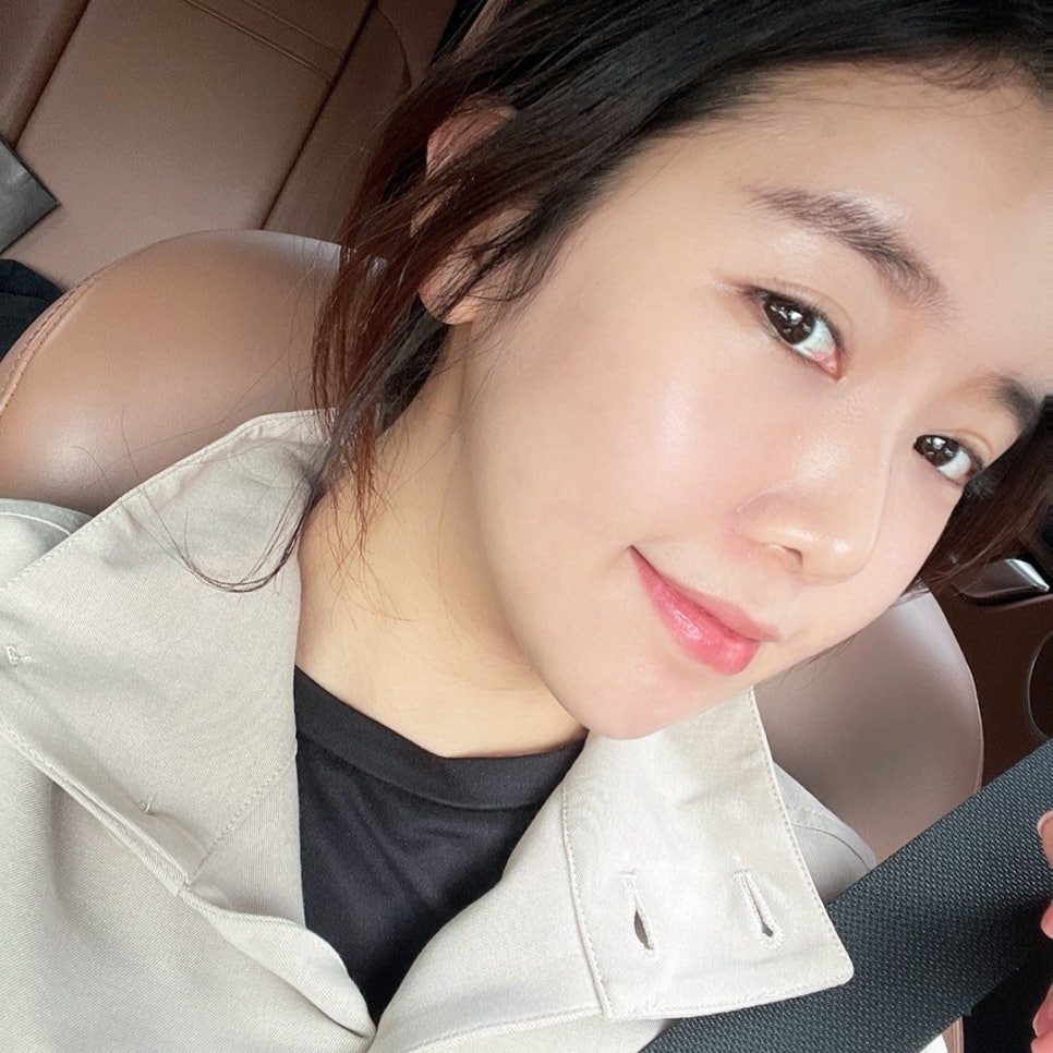 눈 밑 꺼짐 없이 어려보이는 눈밑지방없애는방법 관련 이미지 1