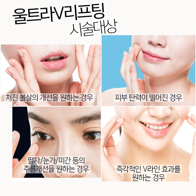 턱살리프팅으로 처진 살 얼른 올리자!~ 관련 이미지 2