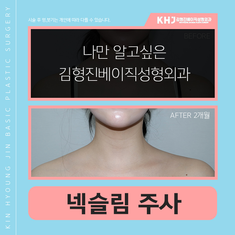 넥슬림주사후기 궁금하시죠? 관련 이미지 4