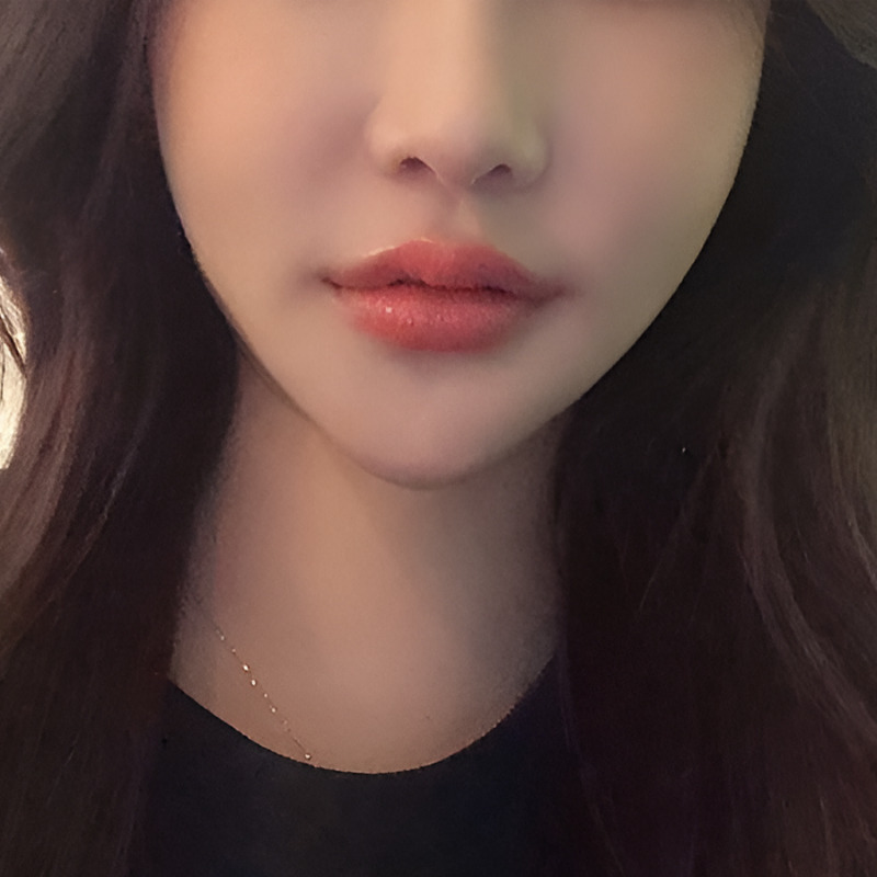 입꼬리필러효과 무표정에도 기분 좋아 보이는 인상으로! 관련 이미지 4
