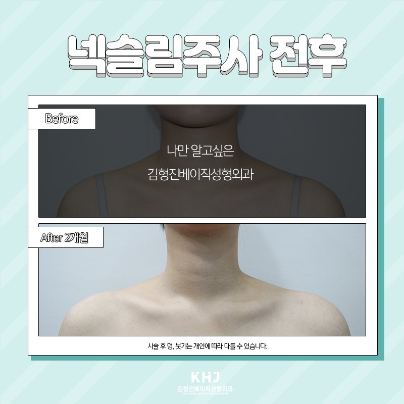 웨딩관리 김형진베이직에서 해야하는 이유 관련 이미지 5