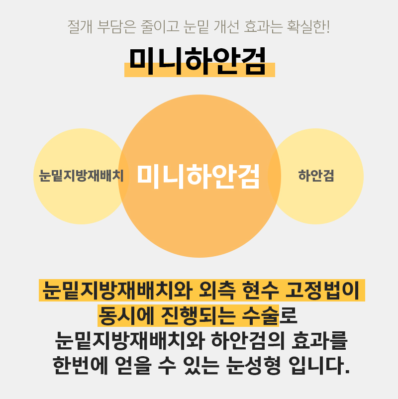미니하안검재수술 발생 확률 적은 김형진베이직 관련 이미지 2