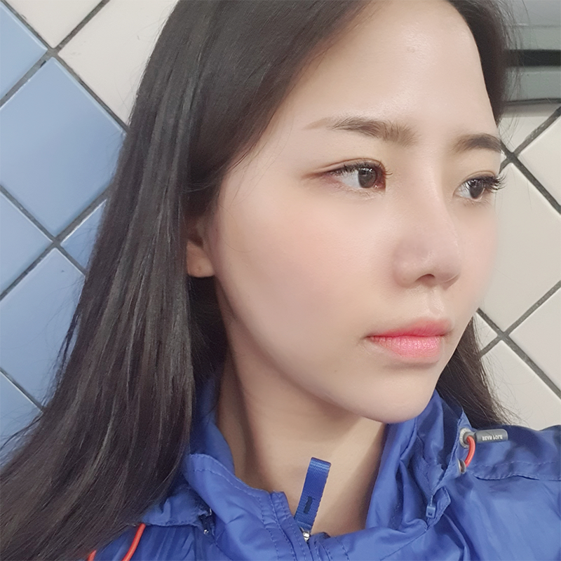 침샘보톡스주기 어떻게 되는 지 궁금하시죠? 관련 이미지 3