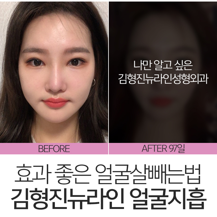 얼굴살빼는법 알아보고 있었다면? 관련 이미지 8