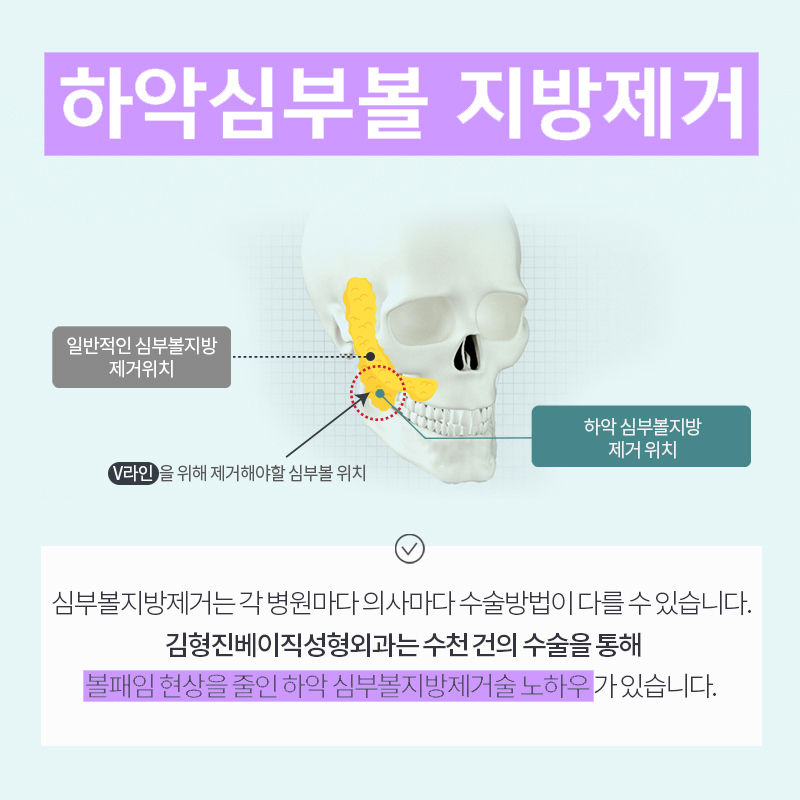 그동안 잘못 알고 있었던 볼살빼는법 관련 이미지 4
