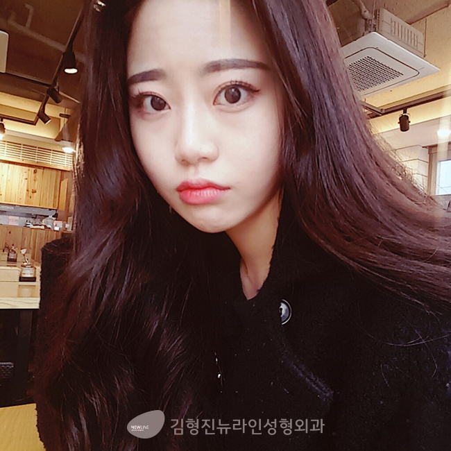 코필러비용 여기서 확인~ 관련 이미지 2