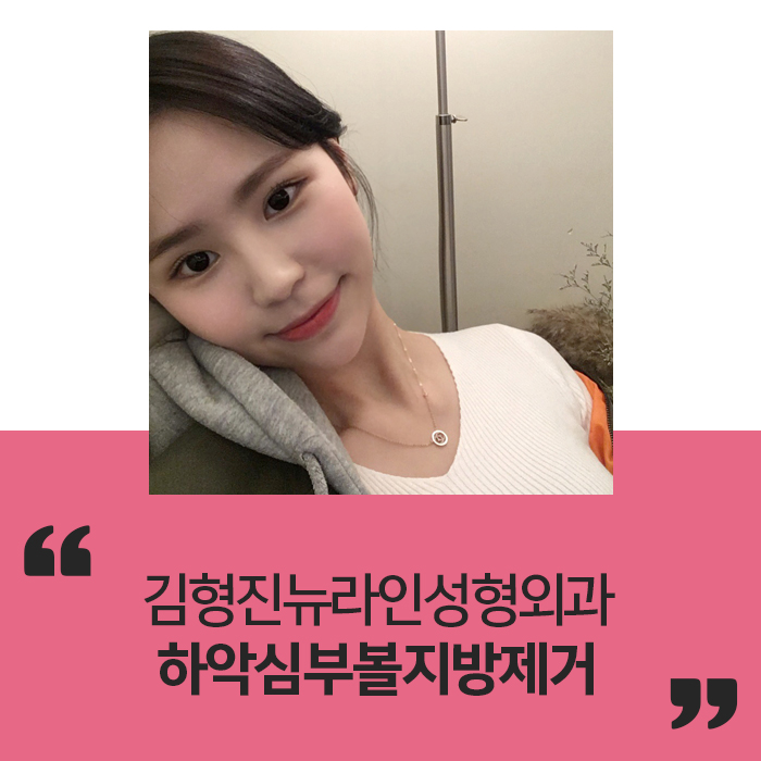 심부볼당일수술 그리고 만족한 결과! 관련 이미지 1