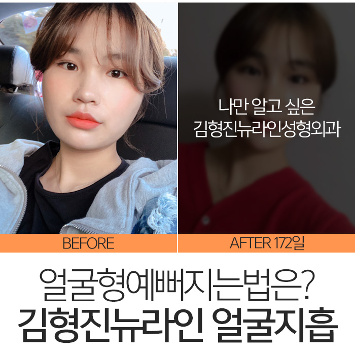 얼굴형예뻐지는법 확실한건 관련 이미지 2